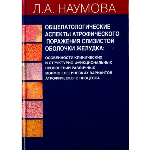 Высшее образование и Наука Общепатологические аспекты атрофического поражения слизистой оболочки желудка Наумова Людмила Алексеевна