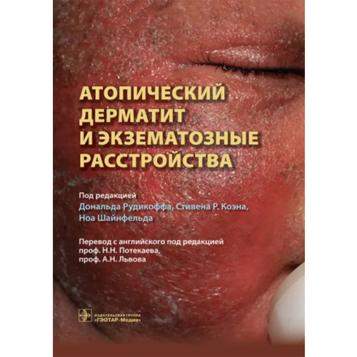 ГЭОТАР-Медиа Атопический дерматит и экзематозные расстройства Рудикофф Дональд, Коэн Стивен Р., Шайнфельд Ноа