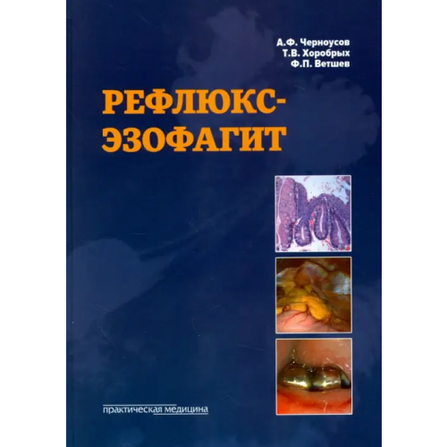 Практическая медицина Рефлюкс-эзофагит Черноусов Александр Федорович, Хоробрых Татьяна Витальевна, Ветшев Федор Петрович