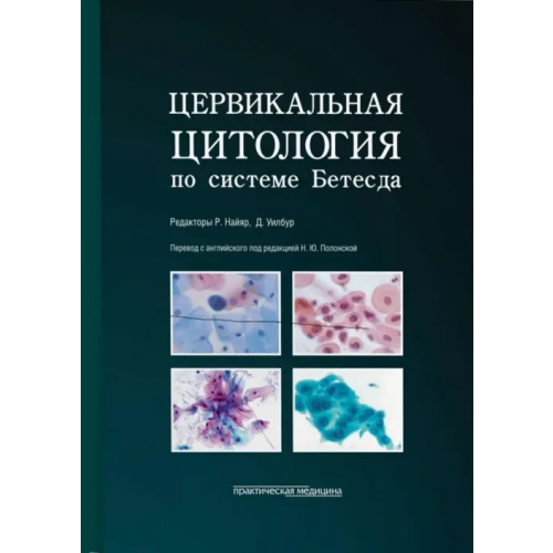 Практическая медицина Цервикальная цитология по системе Бетесда. Терминология, критерии и пояснения