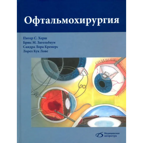 Медицинская литература Офтальмохирургия Херш Питер С., Загельбаум Брюс М.., Кремерс Сандра Лора