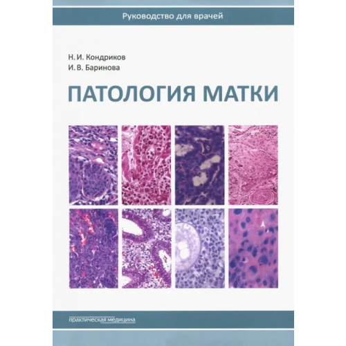 Практическая медицина Патология матки. Руководство для врачей Кондриков Николай Иванович, Баринова Ирина Владимировна