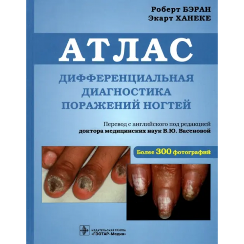 ГЭОТАР-Медиа Дифференциальная диагностика поражений ногтей. Атлас Бэран Роберт, Ханеке Экарт