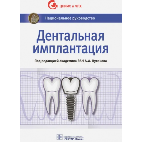 ГЭОТАР-Медиа Дентальная имплантация. Национальное руководство Кулаков Анатолий Алексеевич, Аржанцев Андрей Павлович, Абрамян Сюзанна Владимировна