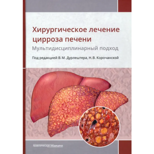 Практическая медицина Хирургическое лечение цирроза печени. Мультидисциплинарный подход. Монография Дурлештер Владимир Моисеевич, Корочанская Наталья Всеволодовна, Габриэль Сергей Александрович