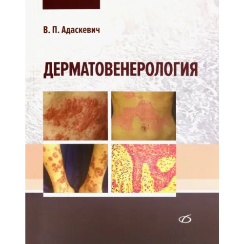 Медицинская литература Дерматовенерология Адаскевич Владимир Петрович