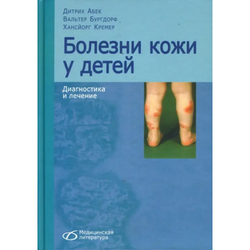 Медицинская литература Болезни кожи у детей. Диагностика и лечение Абек Дитрих, Бургдорф Вальтер, Кремер Хансйорг