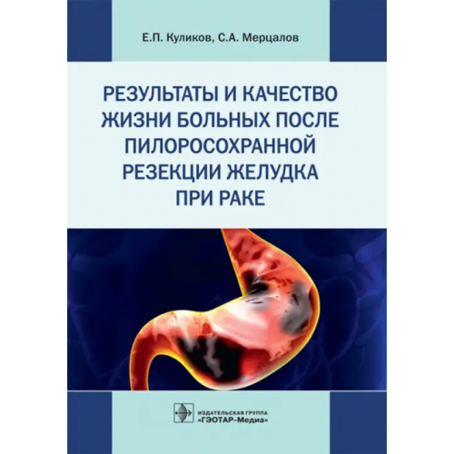ГЭОТАР-Медиа Результаты и качество жизни больных после пилоросохранной резекции желудка при раке Мерцалов Сергей Александрович, Куликов Евгений Петрович