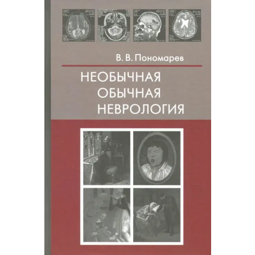 Фолиант (мед.) Необычная обычная неврология. Руководство для врачей Пономарев Владимир Владимирович