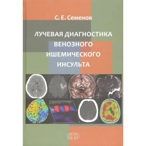 Фолиант (мед.) Лучевая диагностика венозного ишемического инсульта Семенов Станислав Евгеньевич
