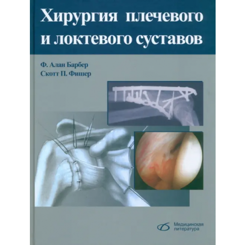 Медицинская литература Хирургия плечевого и локтевого суставов Барбер Алан Ф., Фишер Скотт П