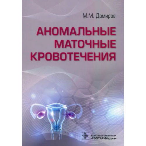 ГЭОТАР-Медиа Аномальные маточные кровотечения Дамиров Михаил Михайлович