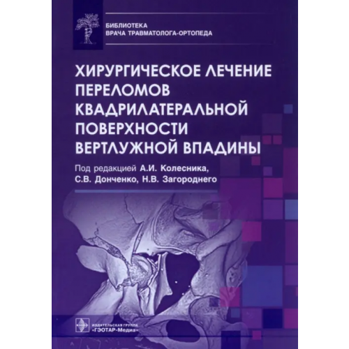 ГЭОТАР-Медиа Хирургическое лечение переломов квадрилатеральной поверхности вертлужной впадины