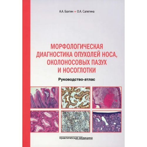 Практическая медицина Морфологическая диагностика опухолей носа, околоносовых пазух и носоглотки. Руководство-атлас Бахтин Артур Александрович, Сапегина Ольга Александровна