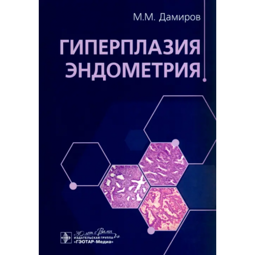ГЭОТАР-Медиа Гиперплазия эндометрия Дамиров Михаил Михайлович, Олейникова О. Н., Шабанов М. А