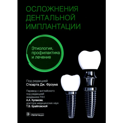 ГЭОТАР-Медиа Осложнение дентальной имплантации. Этиология, профилактика и лечение Фроум Стюарт Дж., Адольфи Дарио, Адольфи Маурицио Контар