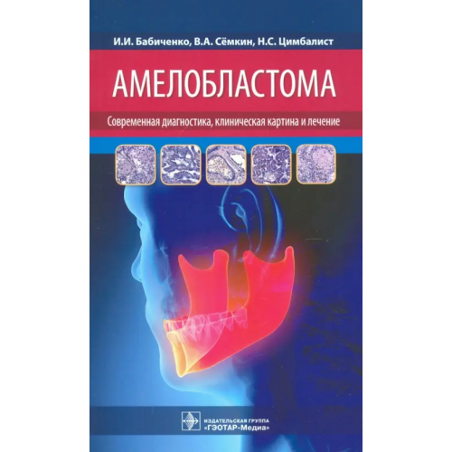 ГЭОТАР-Медиа Амелобластома. Современная диагностика, клиническая картина и лечение Семкин Василий Александрович, Бабиченко Игорь Иванович, Цимбалист Наталья Сергеевна