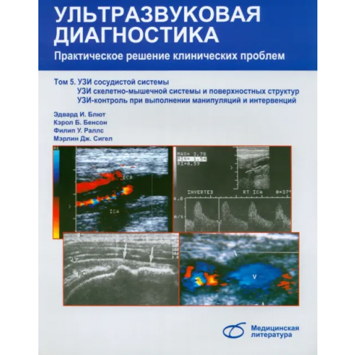 Медицинская литература Ультразвуковая диагностика. Практическое решение клинических проблем. Том 5 Блют Эдвард И., Бенсон Кэрол Б., Раллс Филип У., Сигел Мэрлин Дж
